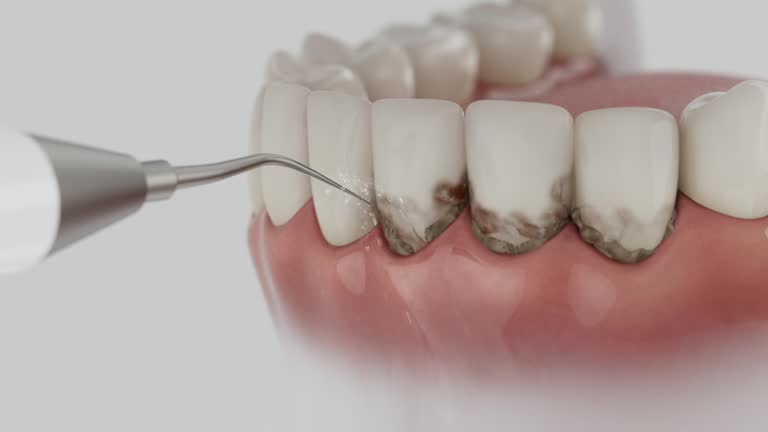 Reliable Dental contractor in Huber Heights, OH by Dentist Open Now